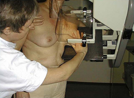 mammorgraphy